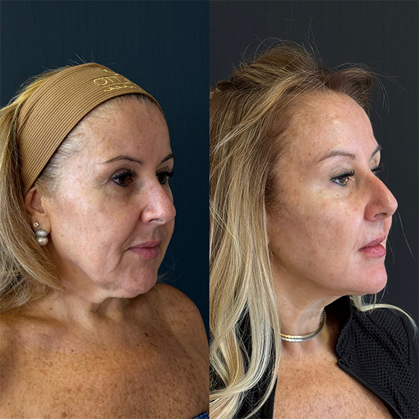 016AC36D-CD51-4D58-AEA7-ADD969881B9A