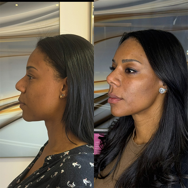 3C4FDB68-A976-4416-8423-D0558ED1D167