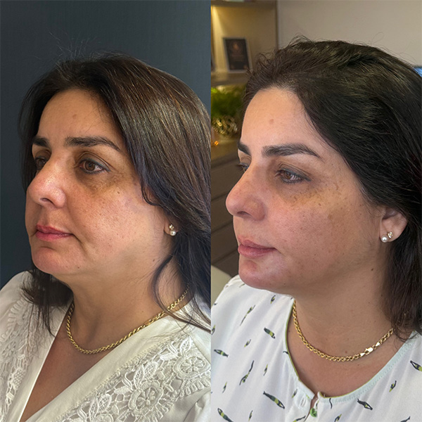 B95130F1-24D7-47E3-93C3-A1EA705EF6BE