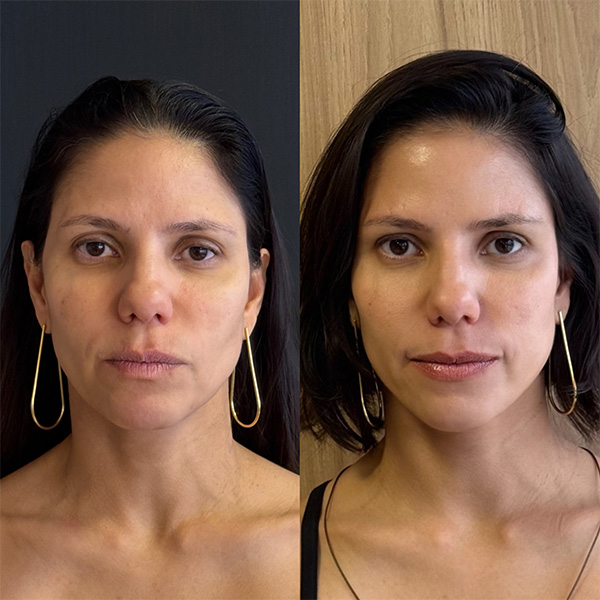 E3D15AE3-B1A9-488E-AB78-ADAEC891E543